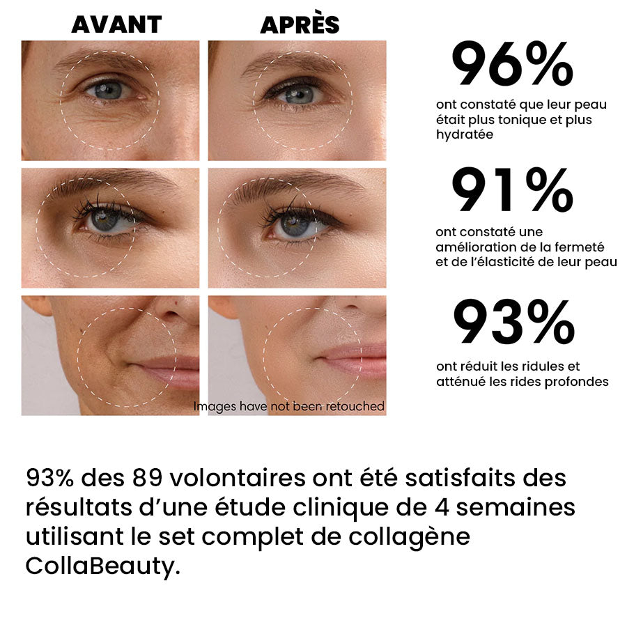 CollaBeauty - Kit complet patchs au collagène soluble